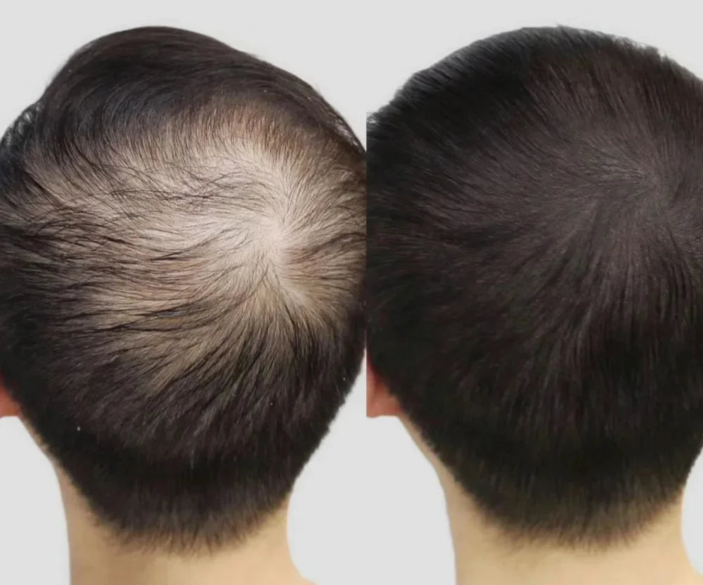 Lustrao Hair Growth Trio